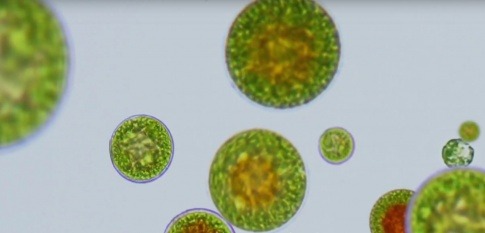 Astaxanthin produzierende Algen unter dem Mikroskop