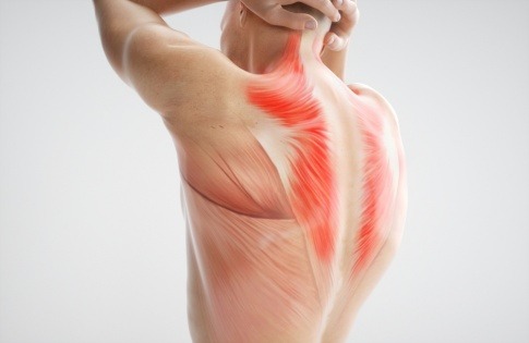 Eine Grafik zeigt die starke Rückenmuskulatur eines Mannes