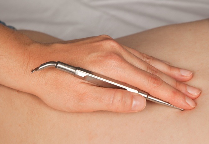 Eine Akupunktmassage wird durchgeführt