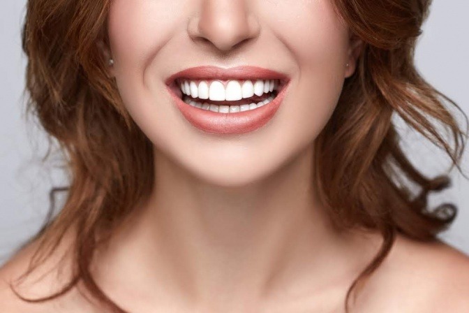 Eine Frau hat bei ihren Zähnen einen All-on-4 Zahnersatz