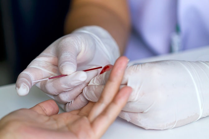 Blutabnahme bei Arzt zur Feststellung des Hämoglobinwertes