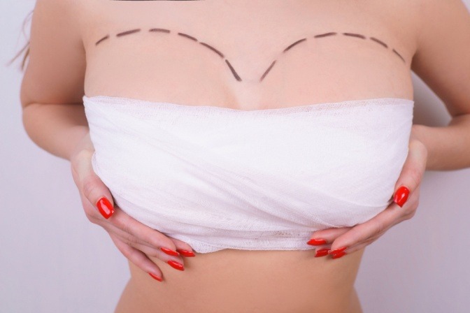Nach Operation bandagierte Brust