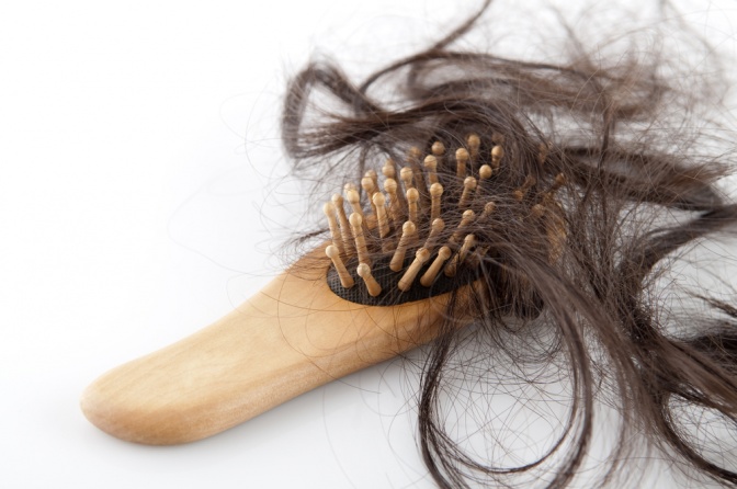 In einer Bürste sind viele Haare wegen Haarausfall