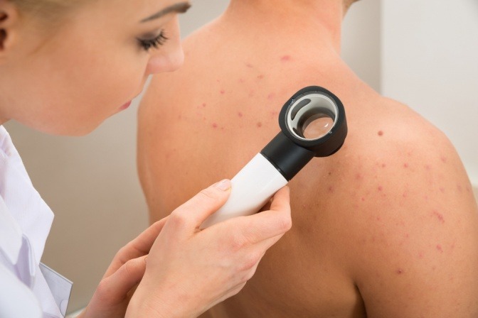 Ein Dermatologe untersucht Hautrötungen