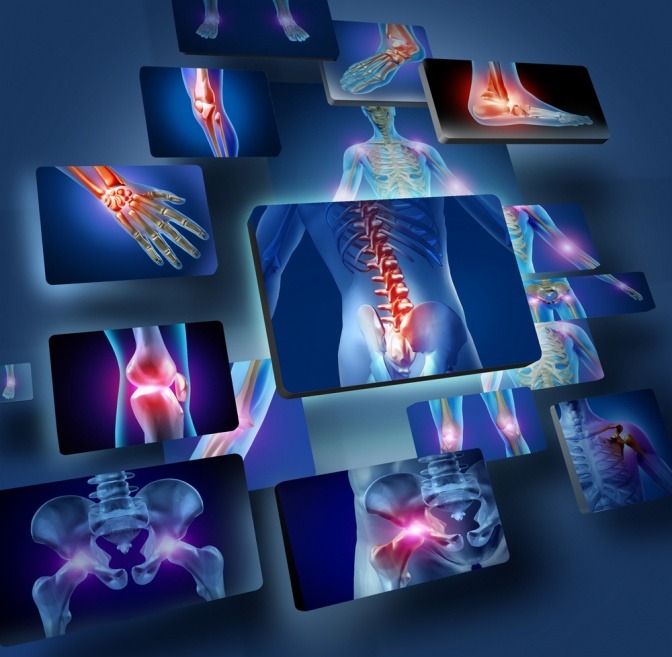 Eine grafische Darstellung der am häufigsten von Gelenkschmerzen betroffenen Körperbereiche.