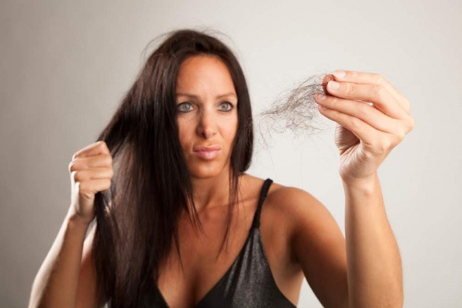 Eine Frau hat Haarausfall