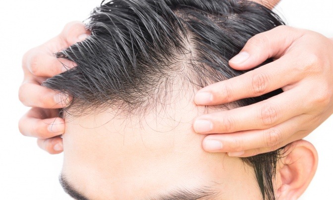 Scheitel eines jungen Mannes mit Kurzhaarfrisur