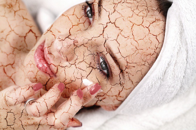 Eine Frau mit ausgetrockneter Haut macht Hautpflege
