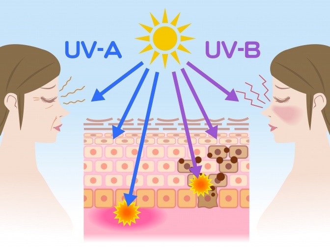 grafische Darstellung von UVA- und UVB-Strahlen in der Haut