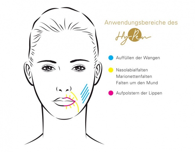 Anwendungsbereiche Hy-Pen.