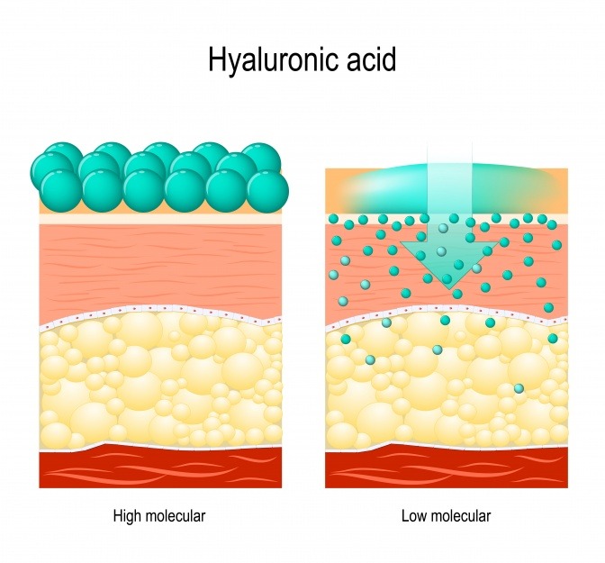 Schema für unterschiedliche Hyaluronsäurearten