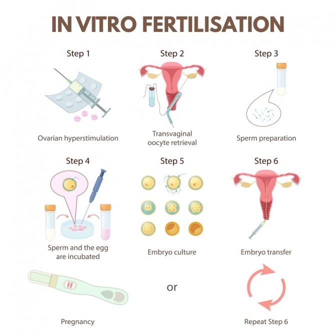 Eine Grafik zeigt, wie künstliche Befruchtung funktioniert