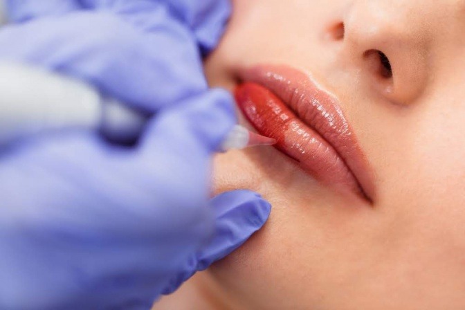 Frau bei einer Permanent Behandlung an den Lippen