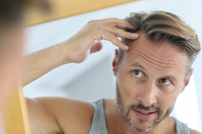 Ein Mann betrachtet seine Haare wegen Ausfall