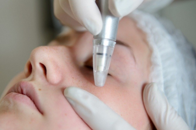 Frau bei einer Mikrodermabrasion Behandlung