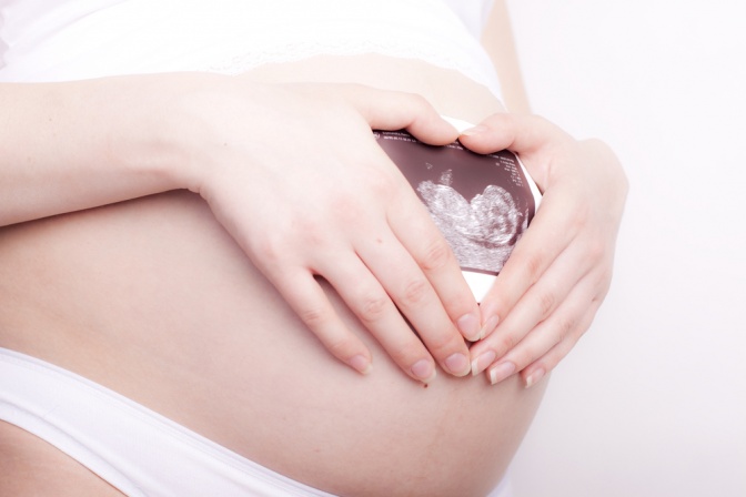 Eine Schwangere nimmt Omega 3 Kapseln