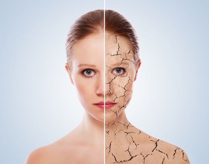 Dehydrierte Haut Wie Du Feuchtigkeitsarme Haut Erkennst