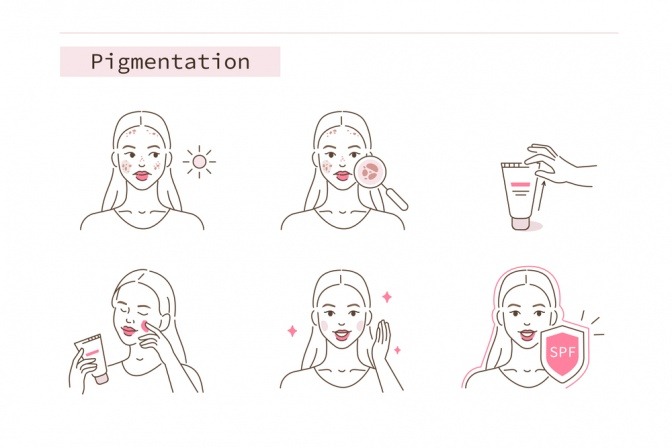 Auf welche Faktoren Sie als Kunde bei der Wahl von Pigmentflecken sonnencreme Acht geben sollten