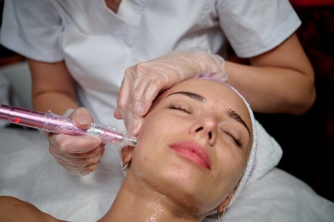 Frau beim Microneedling