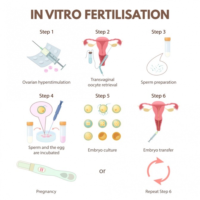 Eine grafische Zusammenfassung der IVF-Behandlung in sechs Schritten.