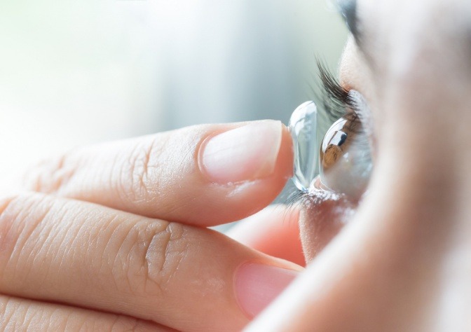 Eine Frau gibt weiche Kontaktlinsen auf das Auge