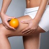 Frau hält eine Orange vor ihr Bein als Symbol für Cellulite