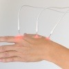 Auf einer Hand wird eine Laserakupunktur durchgeführt