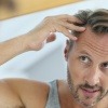 Ein Mann betrachtet seine Haare wegen Ausfall