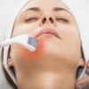 Microneedling mit Dermaroller