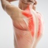 Eine Grafik zeigt die starke Rückenmuskulatur eines Mannes