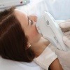 Eine Frau erhält ein Lifting mit einer Ultherapy (Ultraschall Lifting, Salzburg)