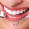 Mund mit Zahnarztgeräten