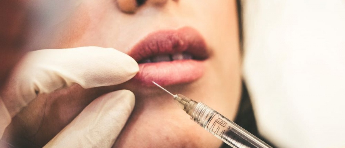 Bei einer Frau wird eine Lippenvergrößerung mit Spritze durchgeführt