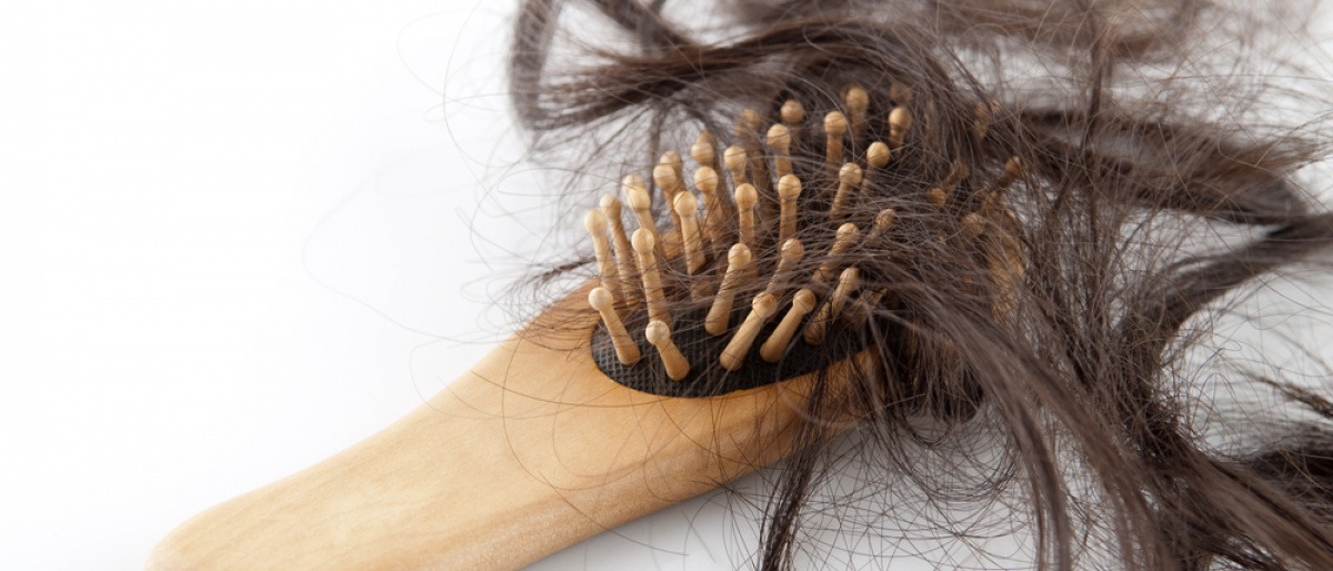 In einer Bürste sind viele Haare wegen Haarausfall
