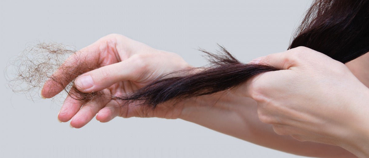 Eine Frau leidet unter Haarausfall bzw. Haarverlust