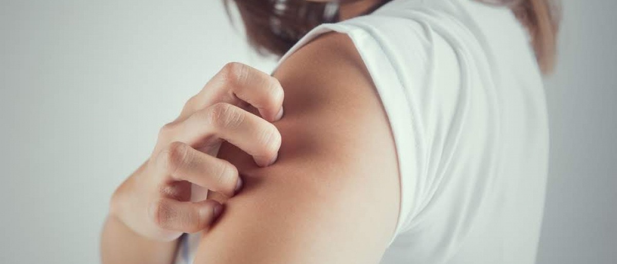 Eine Frau hat Juckreiz wegen Psoriasis