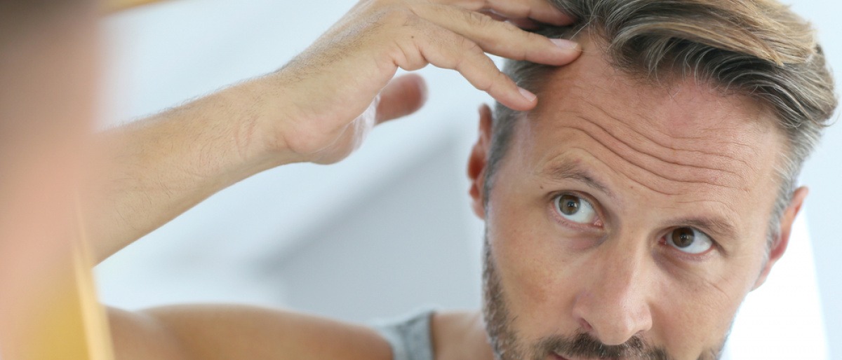 Ein Mann betrachtet seine Haare wegen Ausfall
