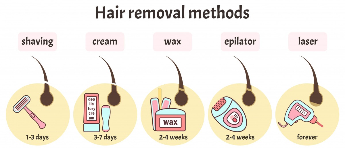 Grafik Haarentfernung eines Damenbarts Methoden