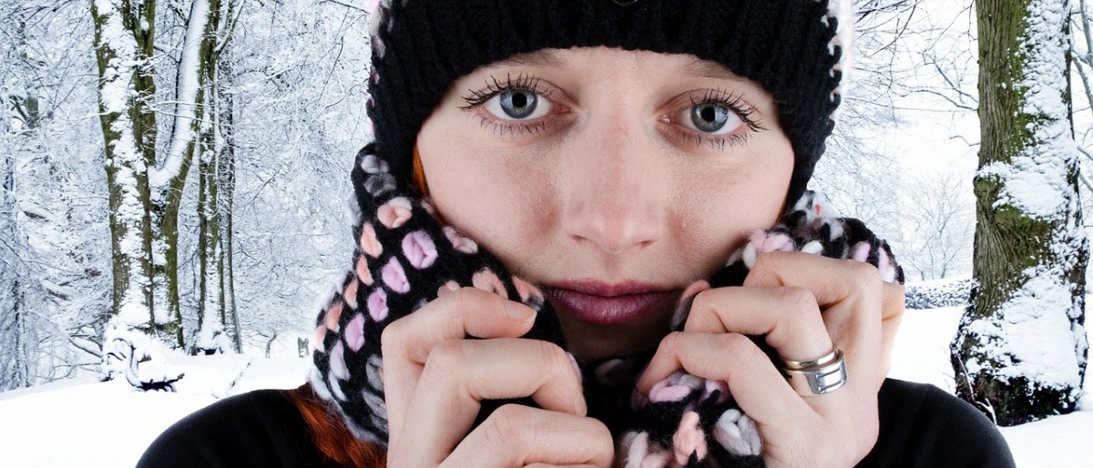 Frau im Schnee mit trockener Haut durch Kälte