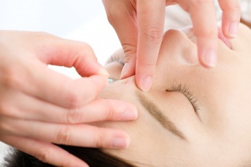 Frau erhält Akupunktur gegen Migräne auf der Stirn