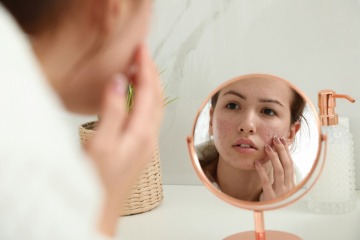 Frau mit Blasenpflaster gegen Pickel betrachtet Haut im Spiegel.