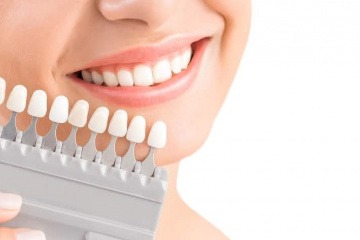 In-Office-Bleaching macht die Zähne um mehrere Nuancen weißer. 