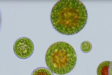 Astaxanthin produzierende Algen unter dem Mikroskop