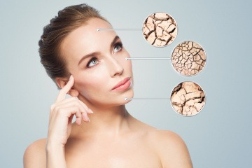 Tipps gegen extrem trockene Haut