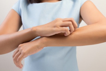 Eine Frau kratzt ihren Arm wegen Neurodermitis, Hautpflege nicht ganz einfach